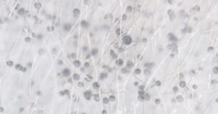 霉菌在显微镜下的形态